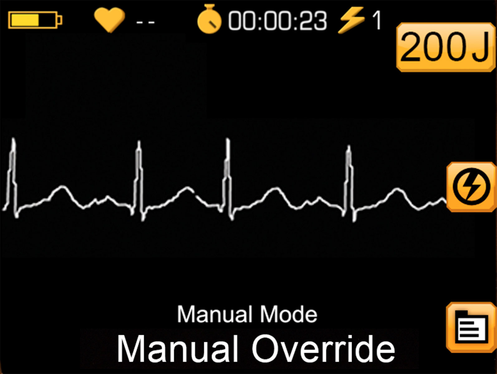 Lifeline Pro AED screen